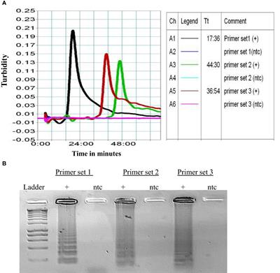 Application of multiple binding sites for LAMP primers across P. falciparum genome improves detection of the parasite from whole blood samples